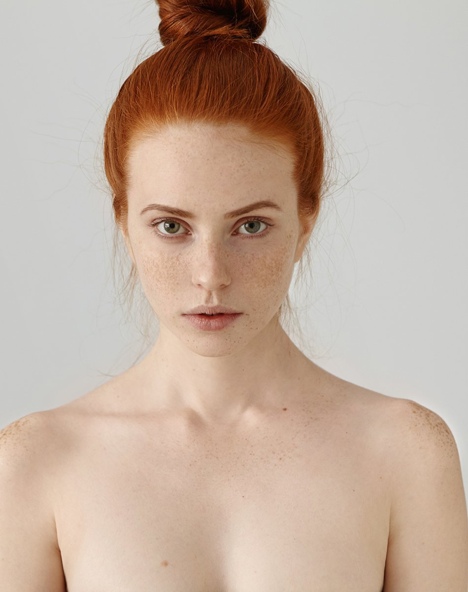 Mentoplasty Surgery in Fairfield County and Darien