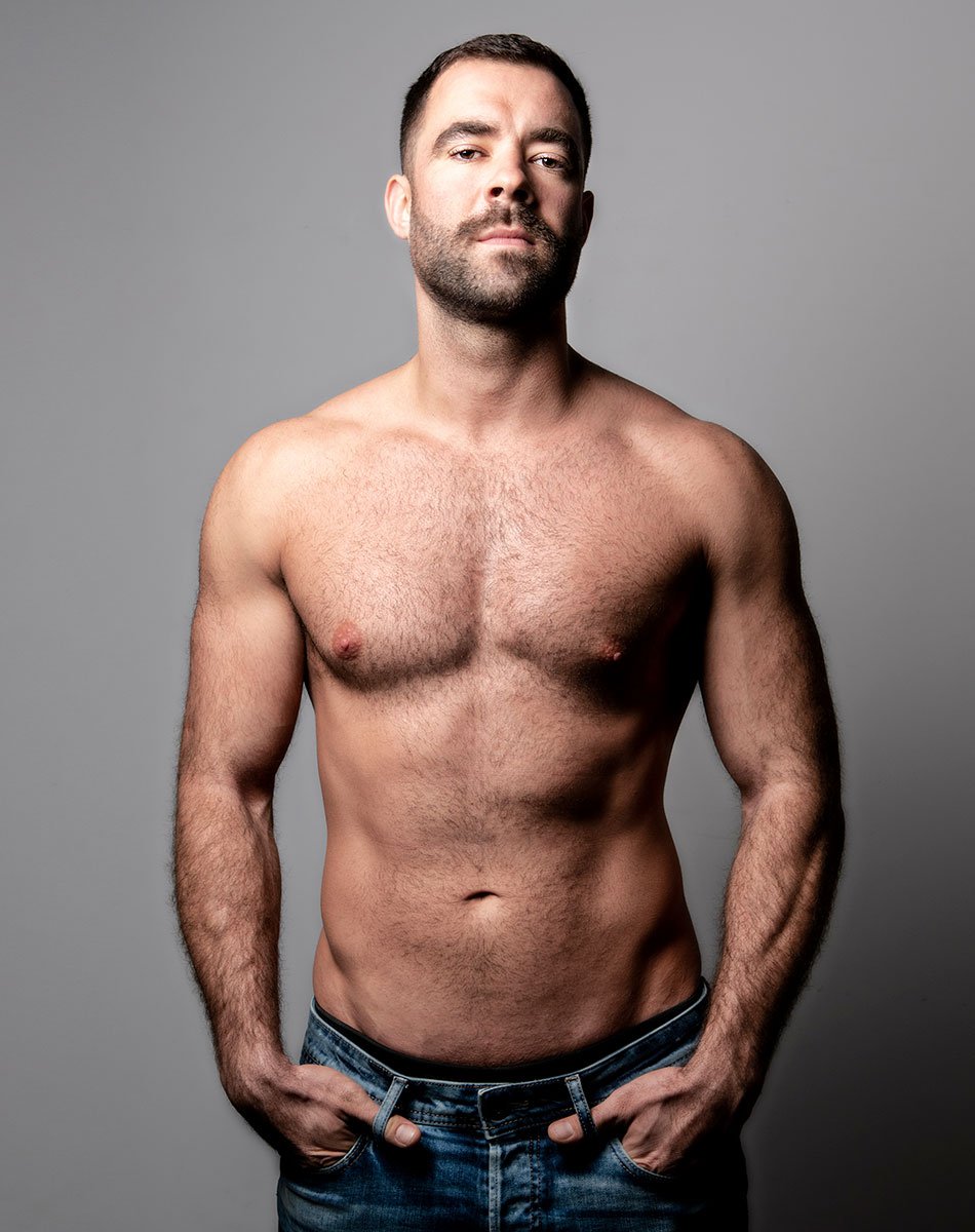 Gynecomastia Surgery Connecticut
