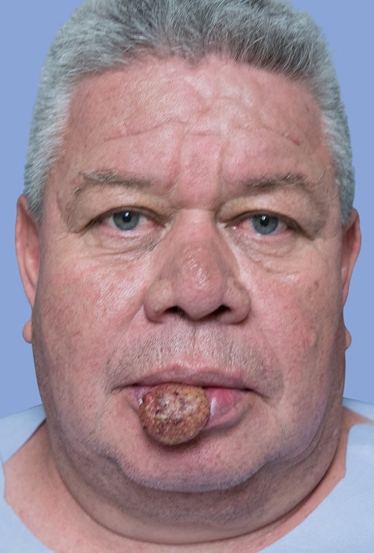 Facial reconstruction Before & After